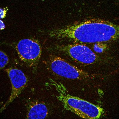 New Chemical Probes Help Scientists Spy on Cells' Eating Habits
