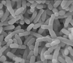 Agrobacterium enlarged 15,000X