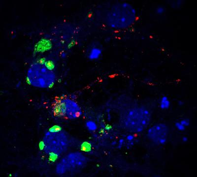 Neurons with Glycogen