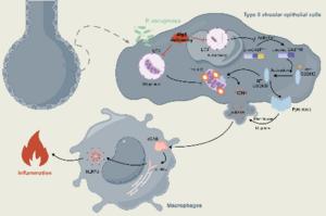 Epithelial Atg5 Deficiency Intensifies Caspase-11 Activation, Fueling Extracellular mtDNA Release to Activate cGAS-STING-NLRP3 Axis in Macrophages during Pseudomonas Infection
