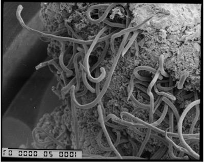 Nematodes