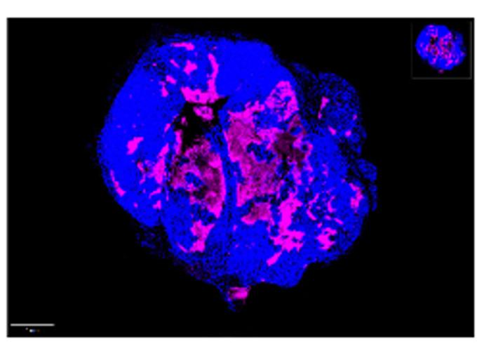 Immunofluorescence CMV