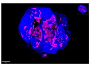 Immunofluorescence CMV