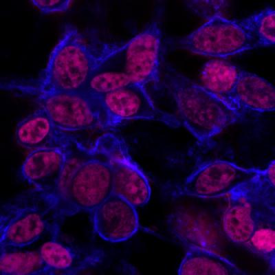 Cancer Cells