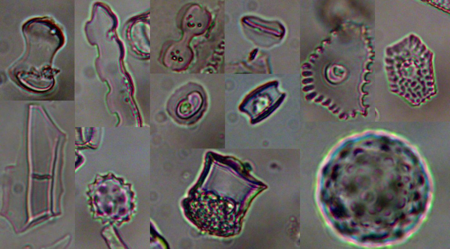 Ancient Plant Remains From Lake Malawi Sediment