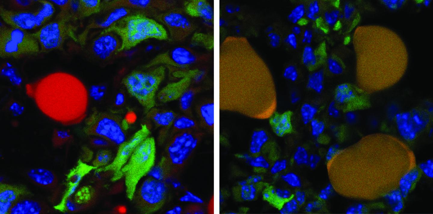 Cancer Cells before and after Therapy