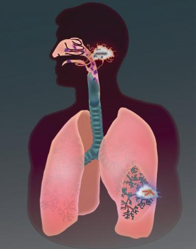 TB's Stealth Attack on Lungs