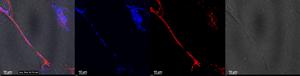Zika virus nanotube video