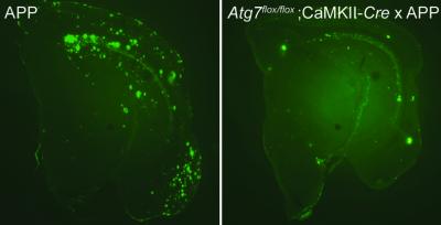 A&#946; Plaque Formation Depends on Autophagy
