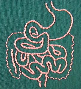Heart disease risk tied to certain molecules made by gut microbes