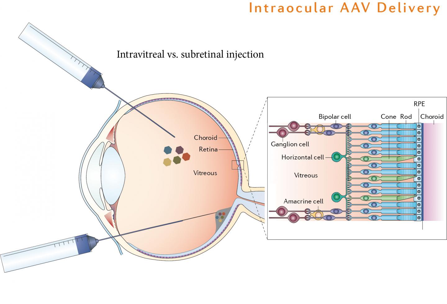 Delivering AAV into the Eye