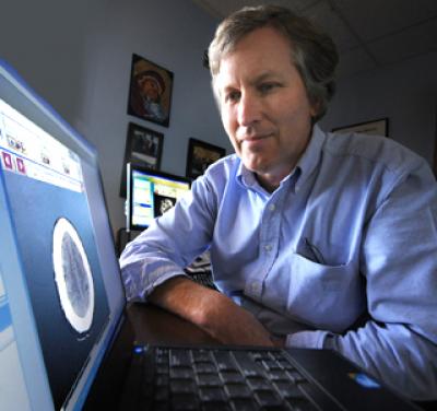 Dr. David Hess, Georgia Health Sciences University