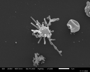 Scanning electron micrograph of a Lokiarchaeum ossiferum cell showing the long and complex cell protrusions.