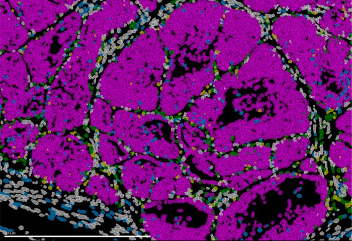 Metastatic ability does not arise randomly and is not exclusively driven by the microenvironment of the target organ