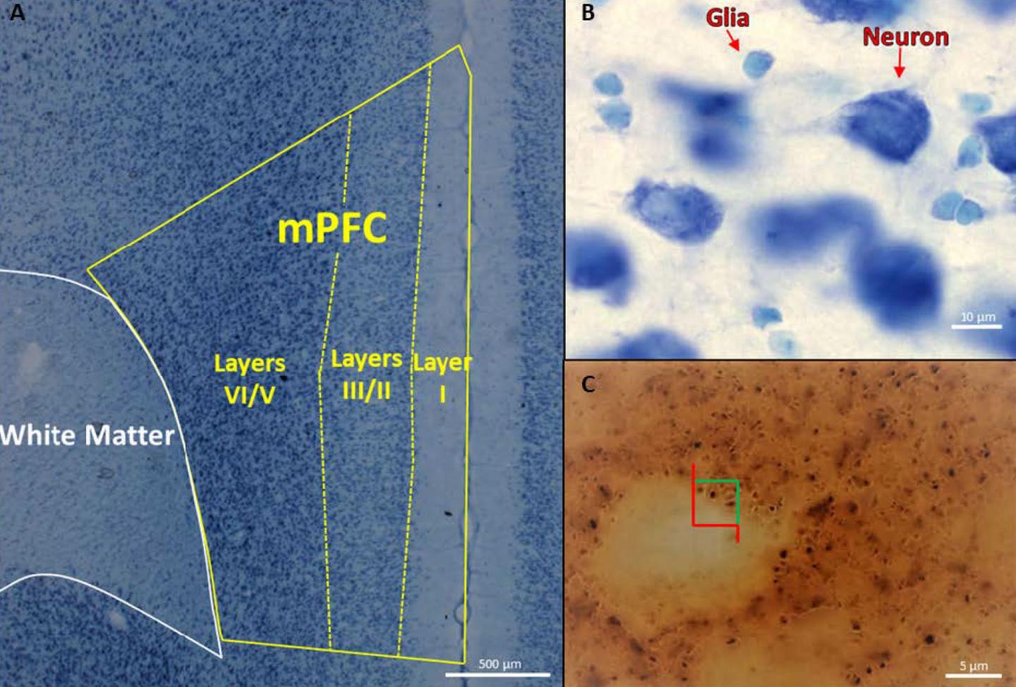 Plastic Chemical, Smaller Cortex