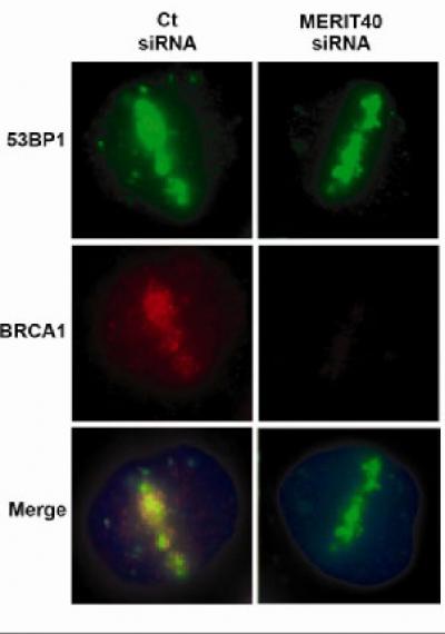 New Protein Important in Breast Cancer Gene's Role in DNA Repair