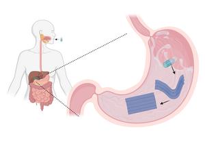 Capsule dissolving in stomach