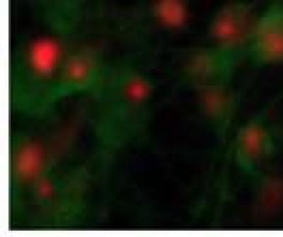Toll-Like Receptor 4
