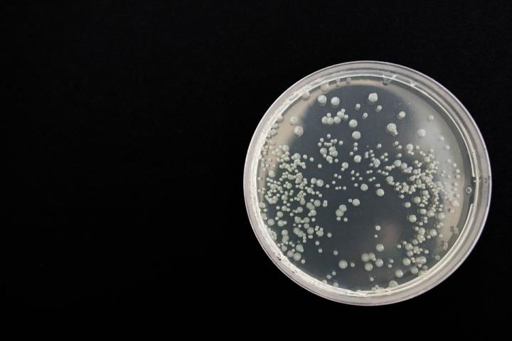 Resource Availability Drives Person-to-Person Variations in Microbes Living in the Body