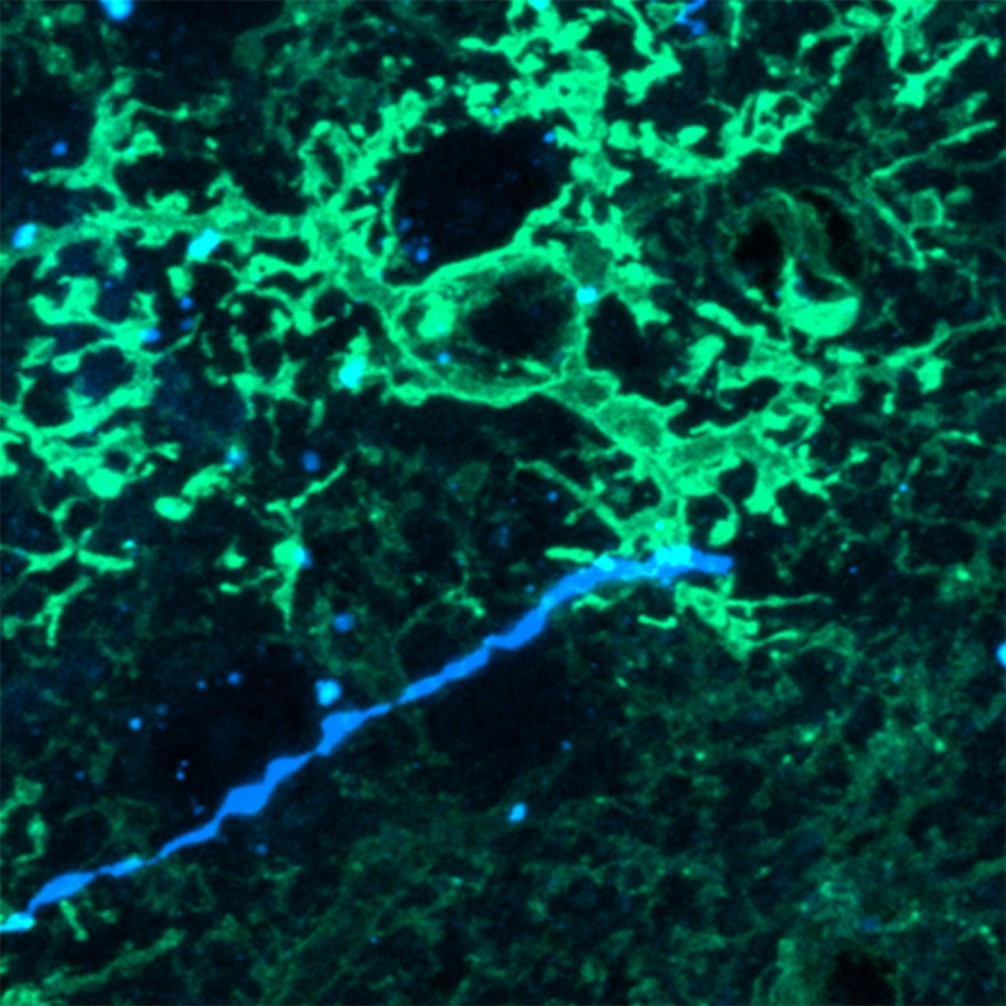 Astrocyte and axon