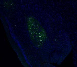 Mouse neurons that control alcohol-isolation connection