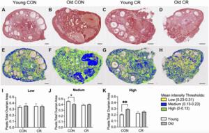 Short-term moderate caloric restriction in the rhesus macaque attenuates markers of ovarian aging in select populations