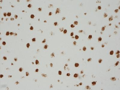 Ghrelin Expression