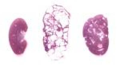 Kidneys