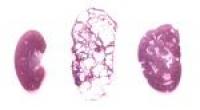 Kidneys