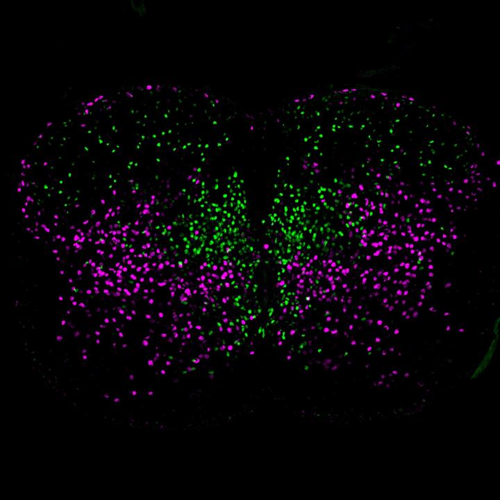 Spinal cord neurons