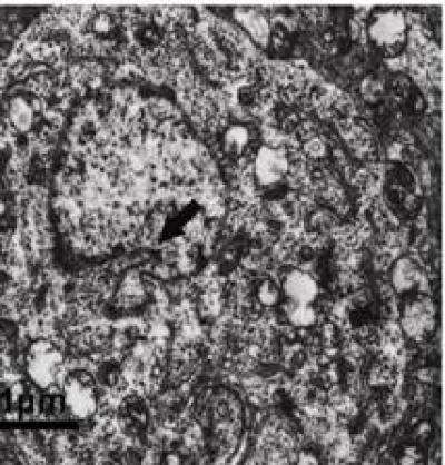 Hippocampal Neurons 