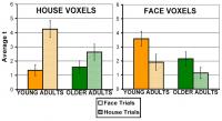Functional Magnetic Resonance Imaging