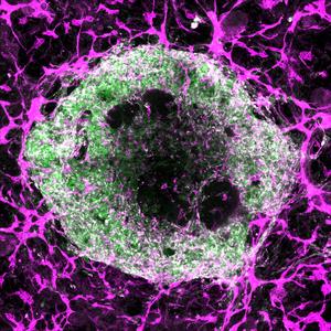 Heart organoid
