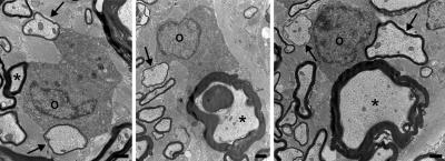 Myelin Recovery Image