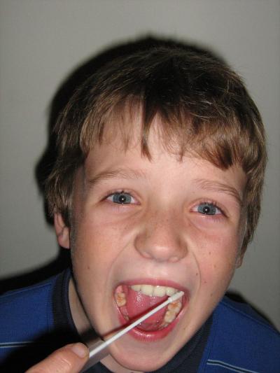 Boy Uses Cheek Swab
