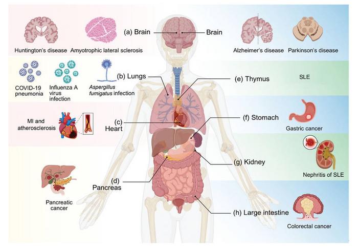 Systemic overview of diseases associated with PANoptosis.