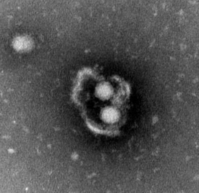 Hepatitis A Virus Discovered to Cloak Itself in Membranes Hijacked from Infected Cells