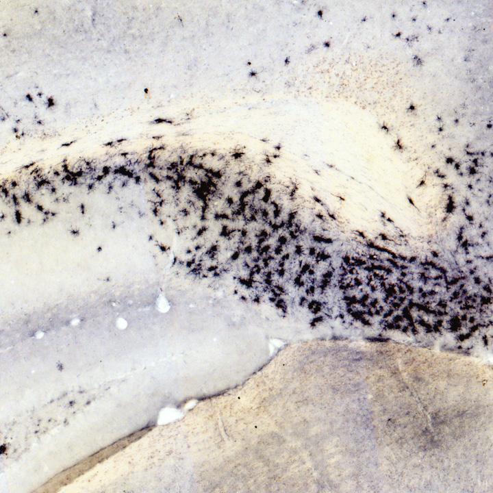 Microglia