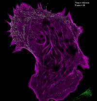High Numerical Aperture Structured Illumination Microscopy (SIM) of Actomyosin Dynamics