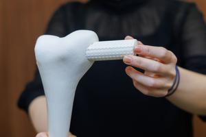 Propelling Biomaterial Innovations for Advanced Cell Therapy