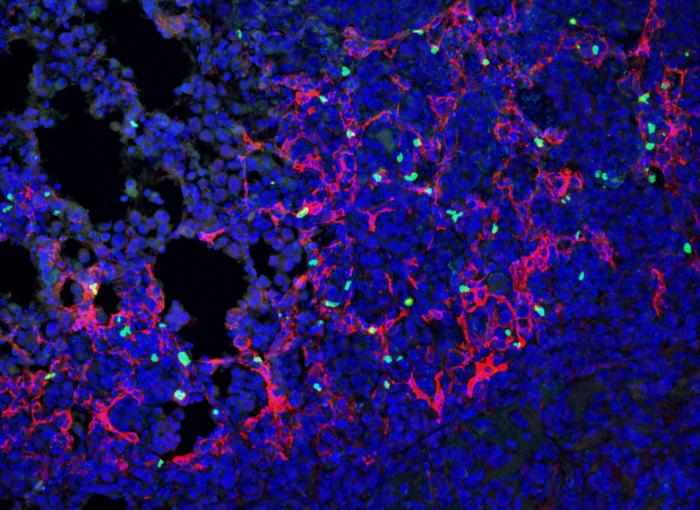Hidden Cell Type Shields Lung Cancer from Immune System