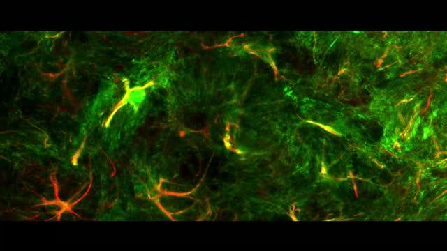 New Insight into Pain Sensation