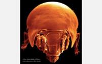 Scanning Electron Microscopy Image