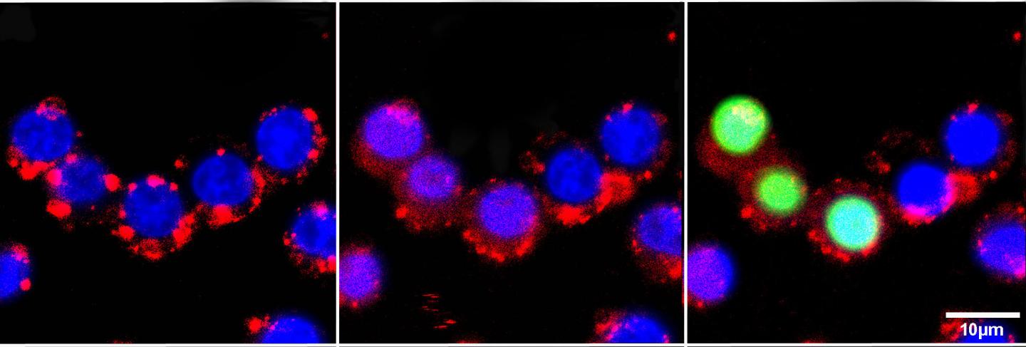 光線力学療法により脳腫瘍細胞死滅させる