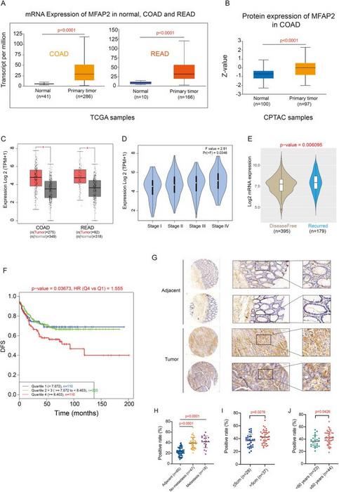 MFAP2 is identified as a potential prognostic biomarker for colorectal cancer (CRC).