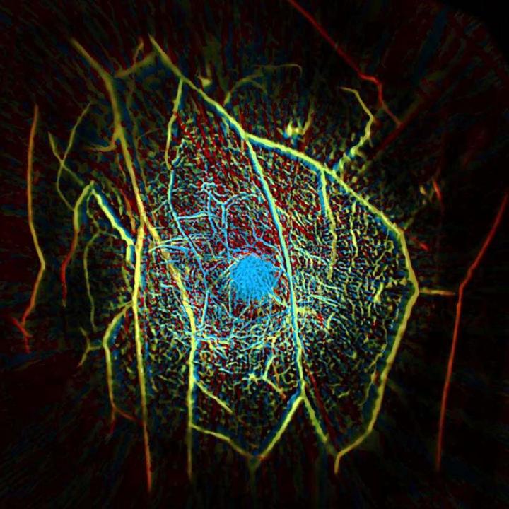 Scan of Breast Vascular Tissue