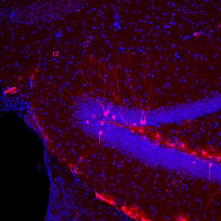 Project Will Investigate Critical Links between Neuroinflammation and Psychopathology