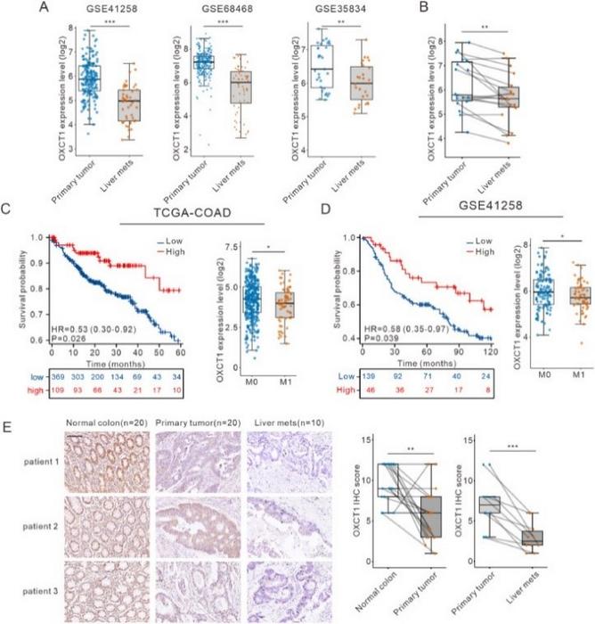 Low expression of OXCT1 was associated with liver metastasis in colorectal cancer