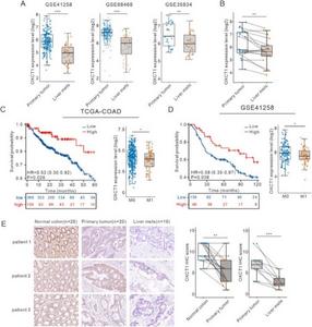 Low expression of OXCT1 was associated with liver metastasis in colorectal cancer