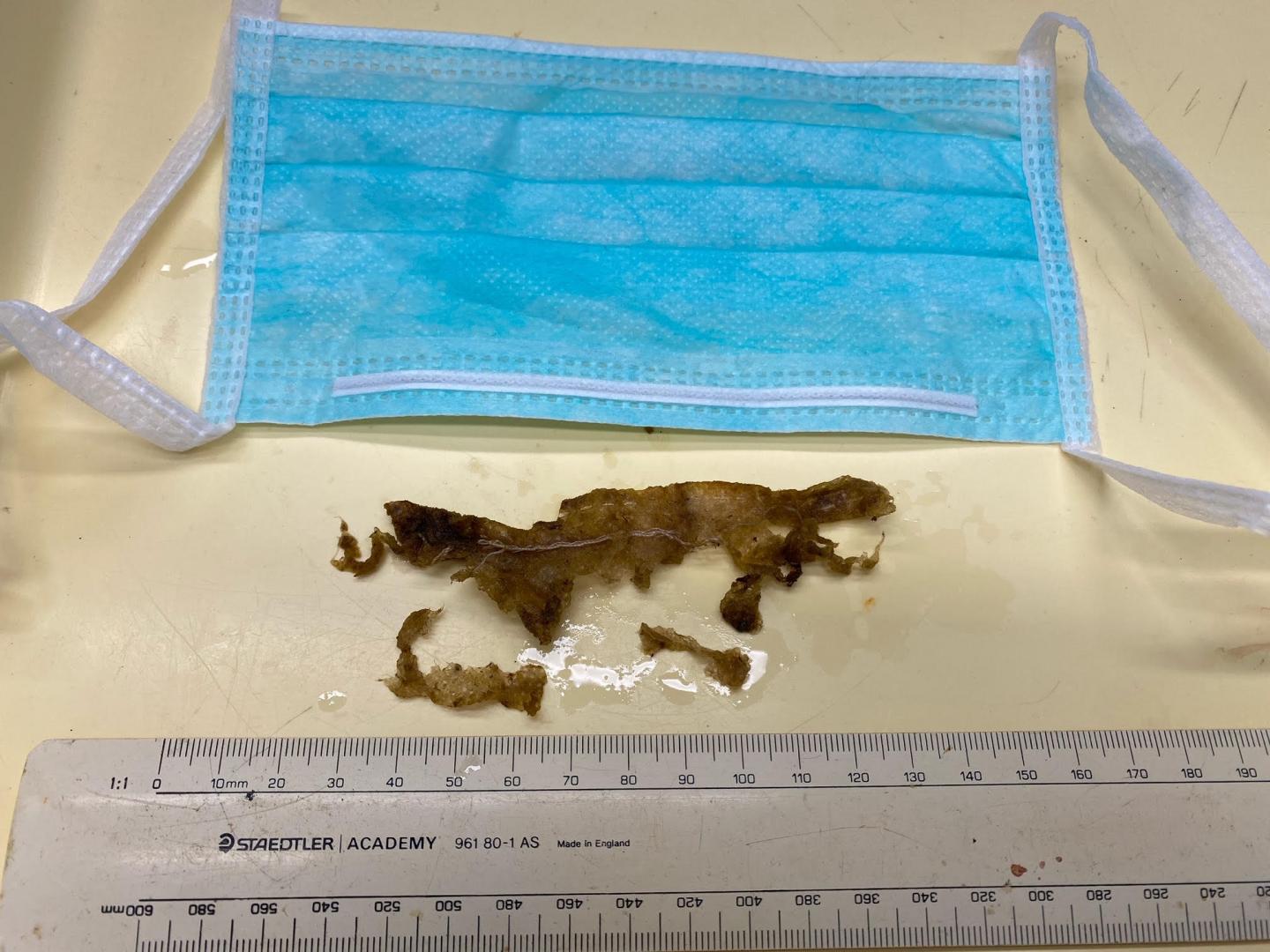 The stomach contents of a Green sea turtle following a necropsy.